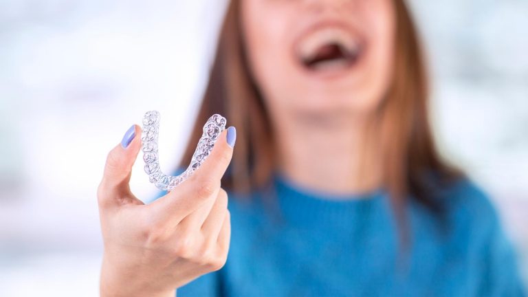 Read more about the article 10 dúvidas comuns sobre o Invisalign